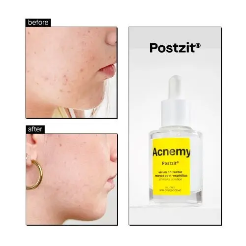 Postzit Zit Marks Solutions - Image 2